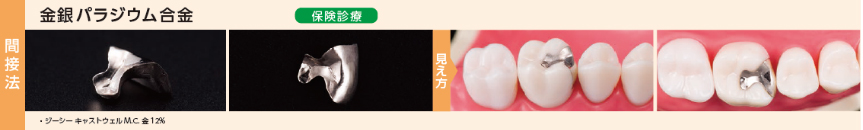 金銀パラジウム合金