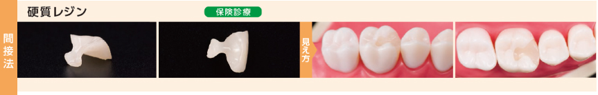 硬質レジン