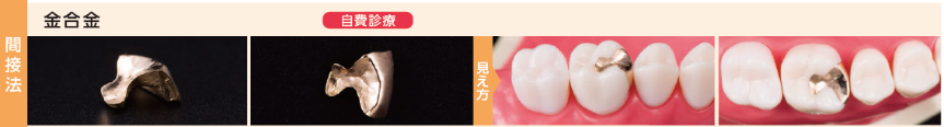 金合金