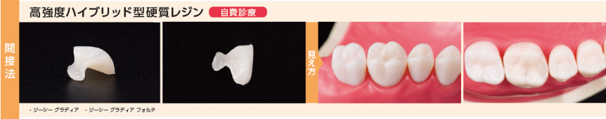 高強度ハイブリッド型硬質レジン