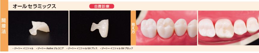 オールセラミックス