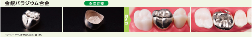金銀パラジウム合金