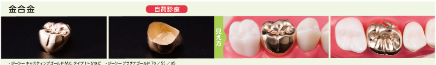 金合金