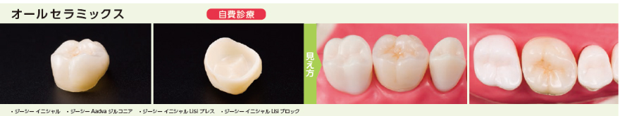 オールセラミックス