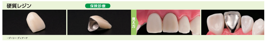 硬質レジン