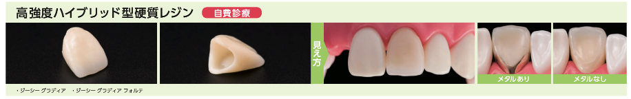 高強度ハイブリッド型硬質レジン