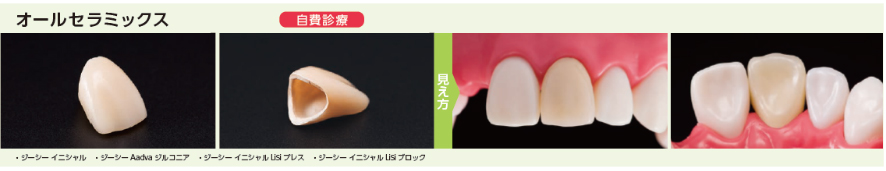 オールセラミックス