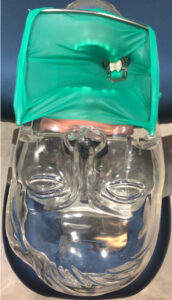 ラバーダム防湿の重要性